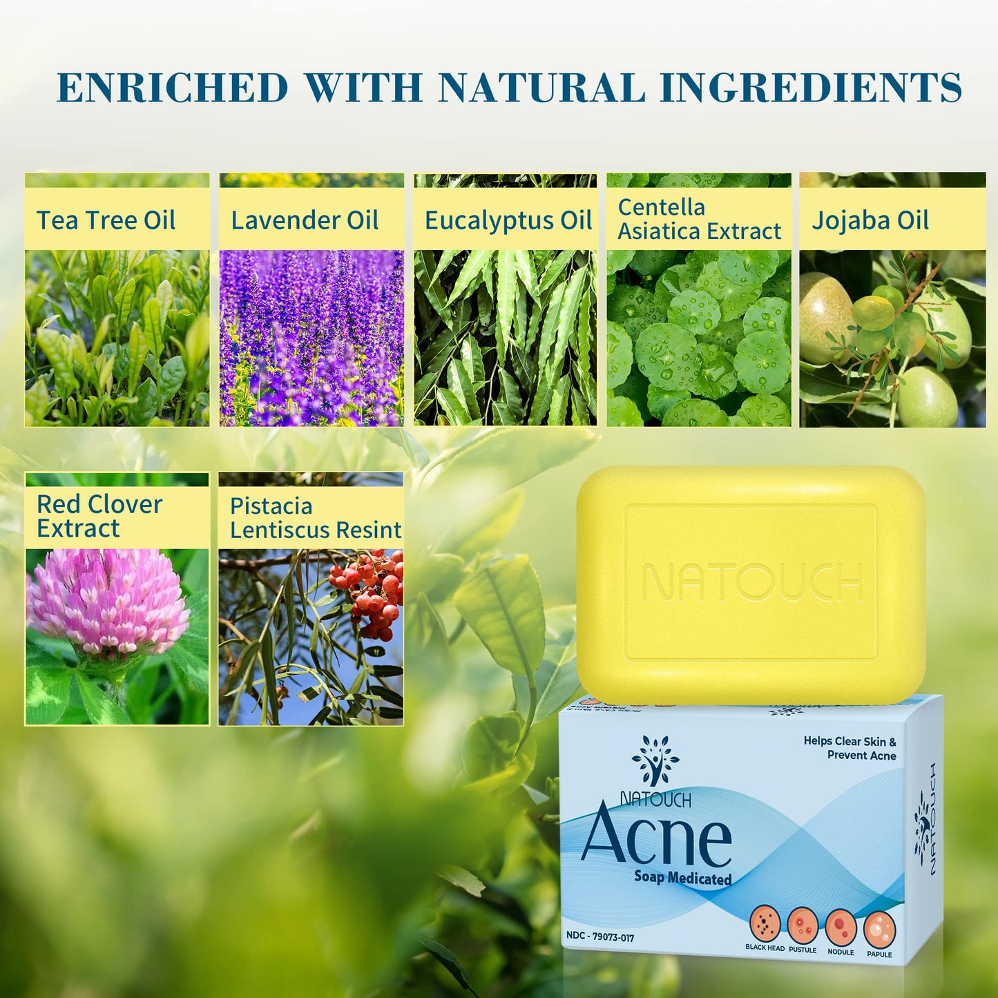 Natouch Acne Treatment Soap Bar, Antifungal Medicated Soap Bar, Acne Body Wash with Salicylic Acid, Acne Scars and Dark Spot Remover with Natural Essential Oil for Face, Body, Back, and Butt - Natouch LLC