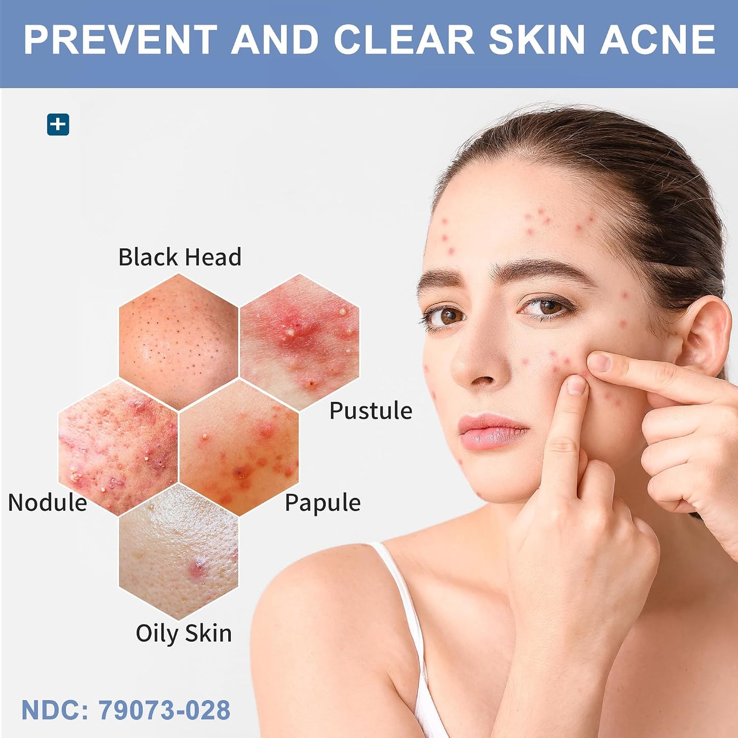 NATOUCH Acne Bar Soap for Face and Body, Medicated Soap Bar, 4 oz, 1 Pack Acne Treatment Cleaning Soap Bar Treats Acne Pimples, Whiteheads, Blackheads, Acne Scars, Dark Spot Remover With Tea Tree Oil