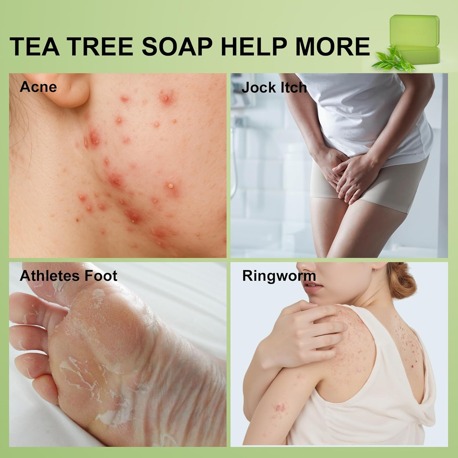 Antifungal Antibacterial Soap Bar for Face & Body Wash, Medicated Bar Soap for Skin Fungus, Jock Itch, Ringworm & Athlete's Foot with Tea Tree Oil, Foot Soap for Men & Women, 8 oz(Pack of 2) - Natouch LLC